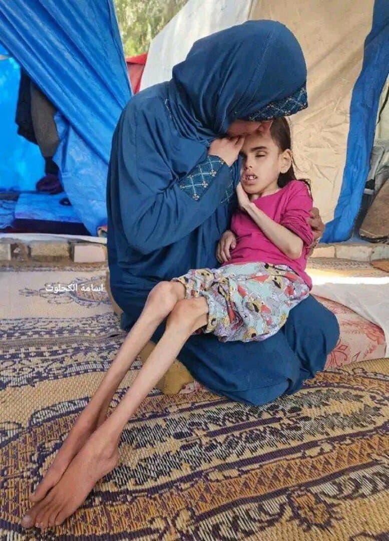 Još devet mrtvih od gladi u Gazi - slika 1