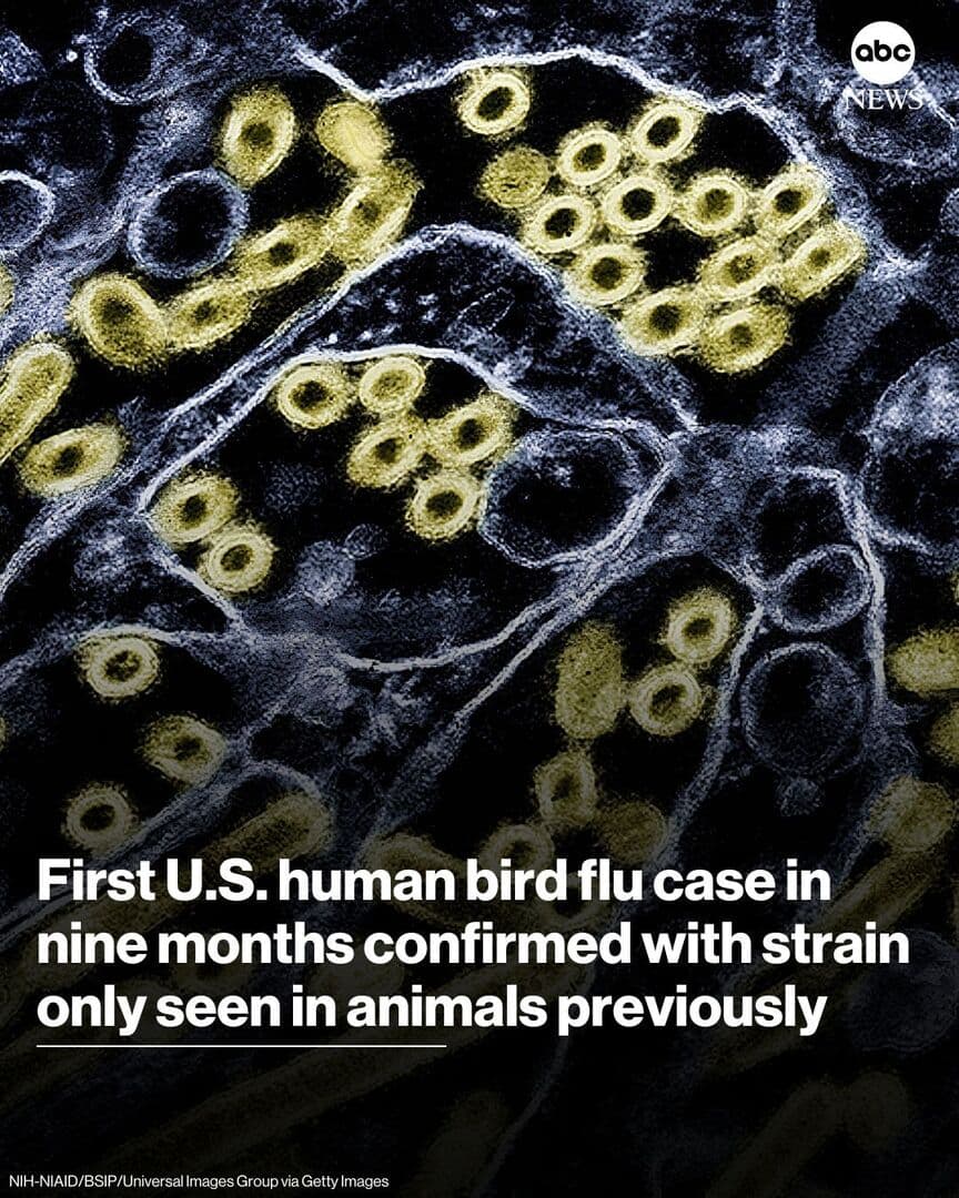 Nova verzija ptičije gripe pronađena kod čovjeka - slika 1