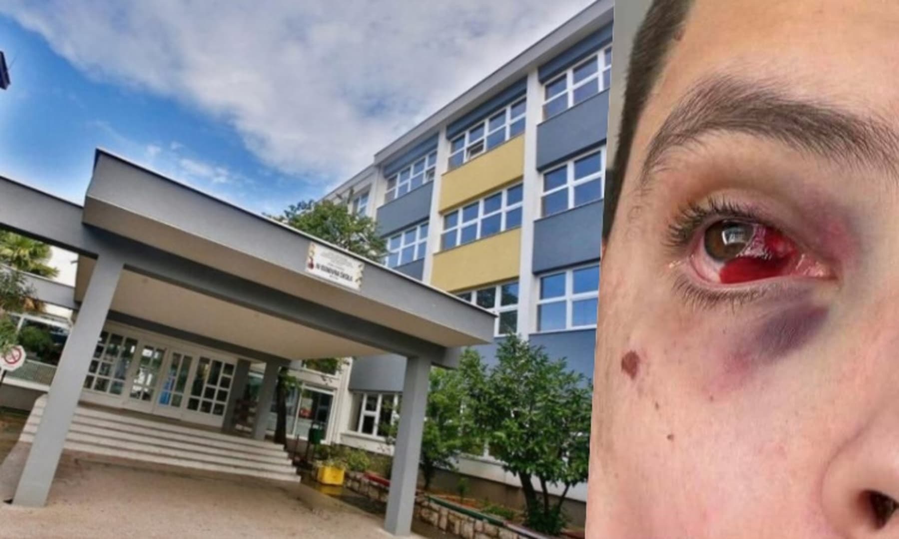 Sutkinja iz Mostara: Nakon što mi je sin ozlijeđen, direktorica nije dopustila nazvat hitnu pomoć - slika 1