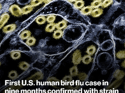 Nova verzija ptičije gripe pronađena kod čovjeka